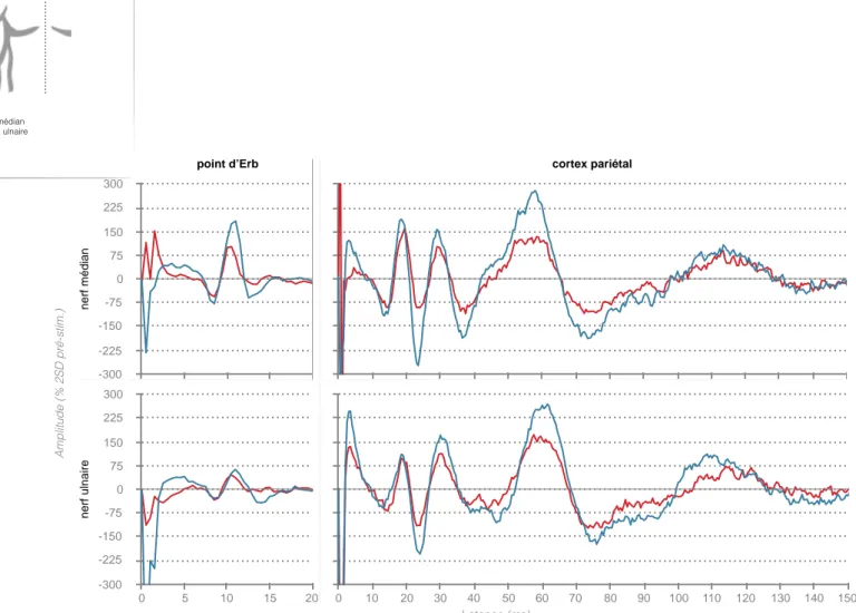 figure 4 : Signal EEG moyen exprimé en pourcentage de 2SD pré-stimulus. participants sains ; patients SLA