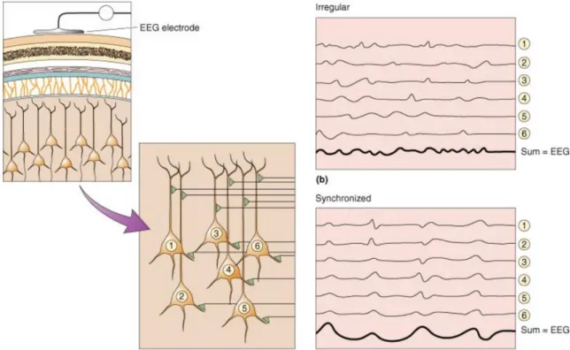 Figure 10: Schéma explicative du signal EEG : chaque neurone numéroté de 1 à 6 peut avoir une activité irrégulière  (panneau en haut à droite) ou synchronisé avec les neurones alentours (panneau en bas à droite).