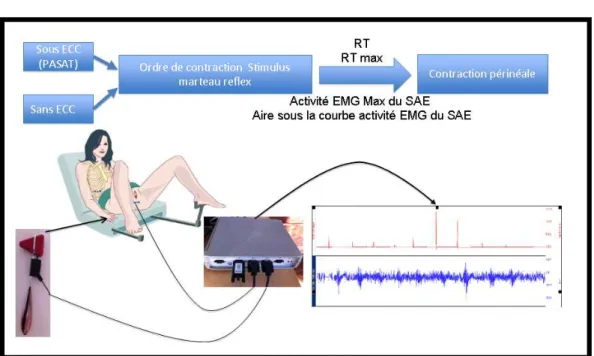 Figure 13 : Technique expérimentale d’enregistrement des contractions  périnéales volontaires avec et sans épreuves de charges cognitives 