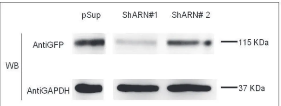 Figure  R-6.  Efficacité  des  constructions  shARN  contre  Susd4.  Western  blot  anti  GFP  de  lysats  protéiques à partir de  cellules HEK exprimant  Susd4-GFP +  pSup (contrôle négatif), ou  Susd4-GFP +  shARN#1,  ou  Susd4-GFP  +  shARN#2