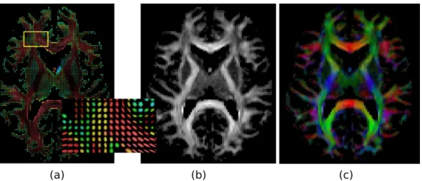 Figure 3.7: Diffusion Tensor Imaging (DTI). (a) DTI ellipsoids from an axial slice of the brain, with zoom