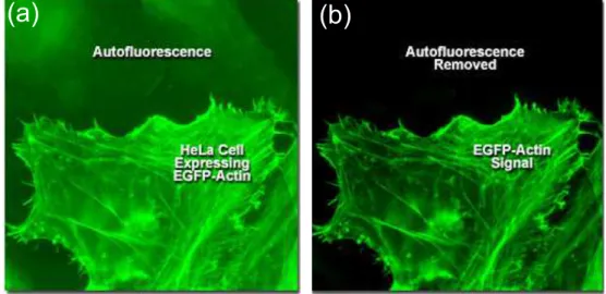 Figure 1.8: Example of autofluorescence phenomena. Retrieved from ZEISS website: http://zeiss-campus.magnet.fsu.edu/articles/