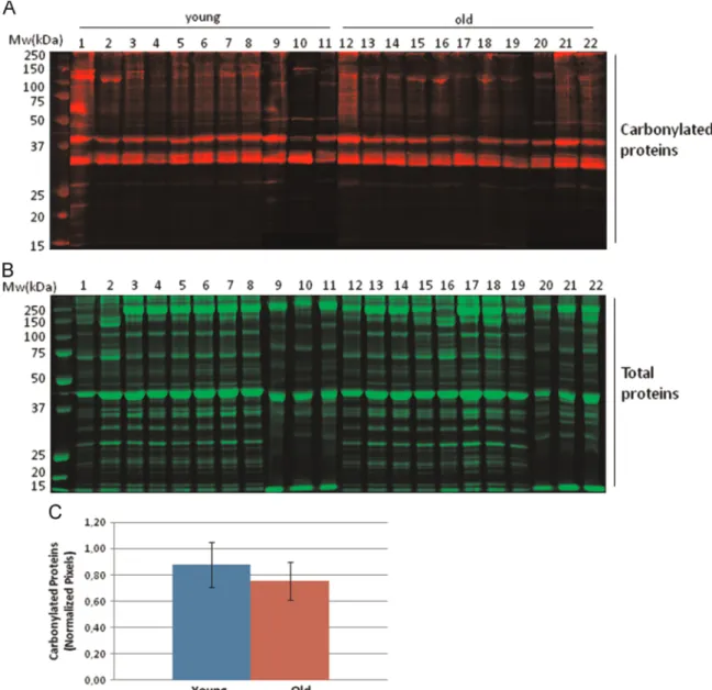 Fig. 1. Analysis of total carbonylated proteins of human rectus abdominis muscle biopsies