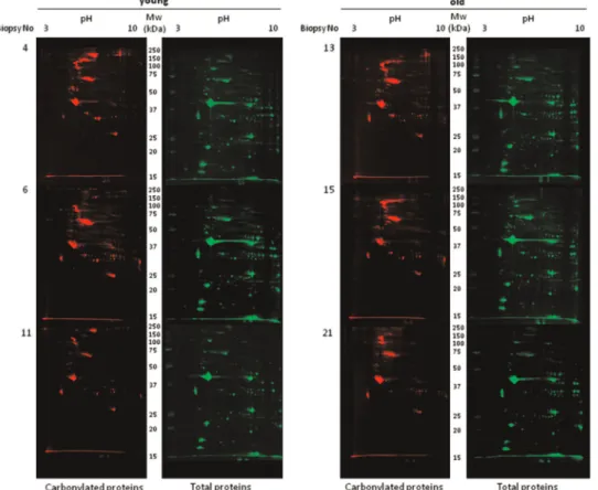 Fig. 2. Oxi-proteome analysis of young and old human skeletal muscle samples. Protein extracts from young (n¼3) and old (n¼3) human skeletal muscle biopsies were separated by 2D gel electrophoresis
