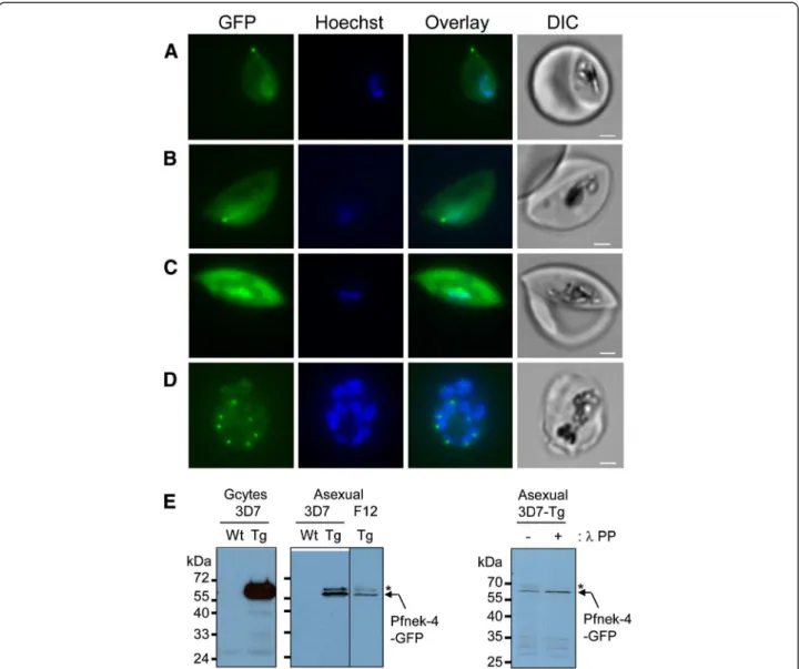 Figure 1 Episomal expression of GFP-tagged Pfnek-4 protein in gametocytes and a subset of asexual stage parasites