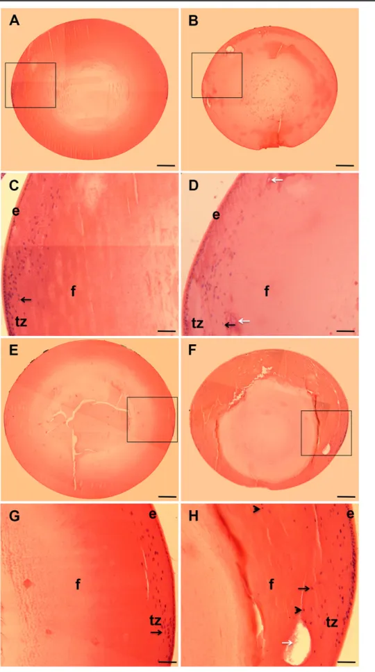 Figure 2. The absence of Dp71 is  associated with histological  altera-tions of the crystalline lens