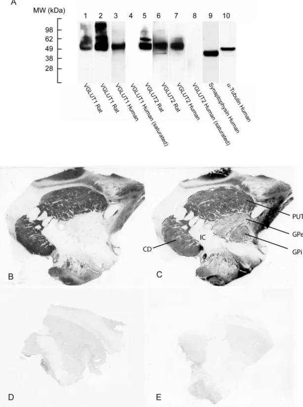 Fig. 1. Distribution of VGLUT1 and VGLUT2 in human basal ganglia. Immunoblots (A) were performed using rat  (lanes 1, 2, 5 and 6) or human (lanes 3, 4, 7-10) putamen extracts with  the following antiserums: anti-VGLUT1  from [29] (lanes 1, 3, 4) or from Ch