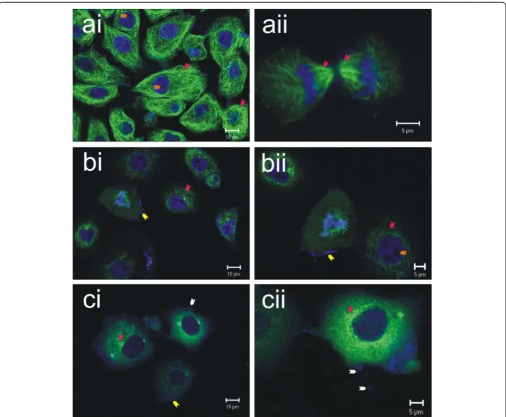 Figure 11 Confocal microscopic immunofluorescent images of the microtubule structure within ESE-16-exposed HeLa cells