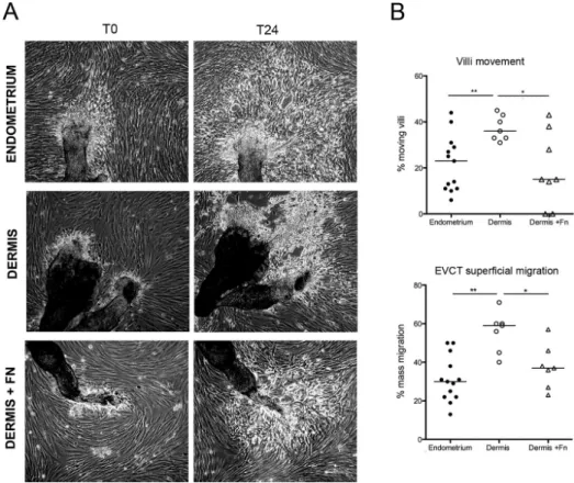 FIGURE 6:  Fibronectin supplementation of the dermis cell layer enhances trophoblast interstitial  migration