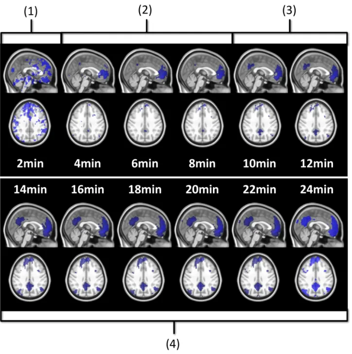 Figure 2. Seed-based estimation of the DMN with prefrontal seed at different acquisition durations