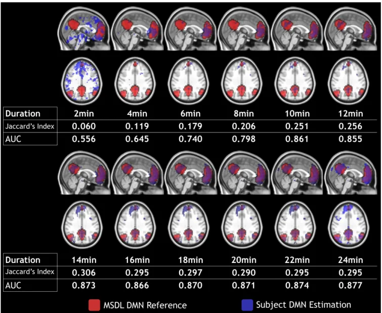 Figure 4. Subject 4 DMN detection (in blue) with prefrontal seed and MDSL DMN reference (in red) over a 2 min to 24 min duration with 2 min steps