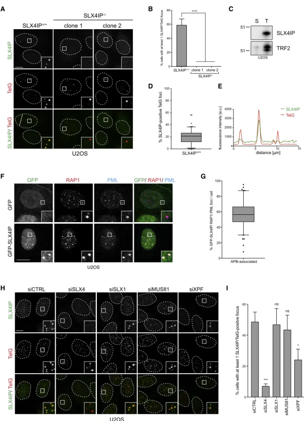 Figure 1. SLX4IP Localizes at Telomeres in an SLX4-Dependent Manner