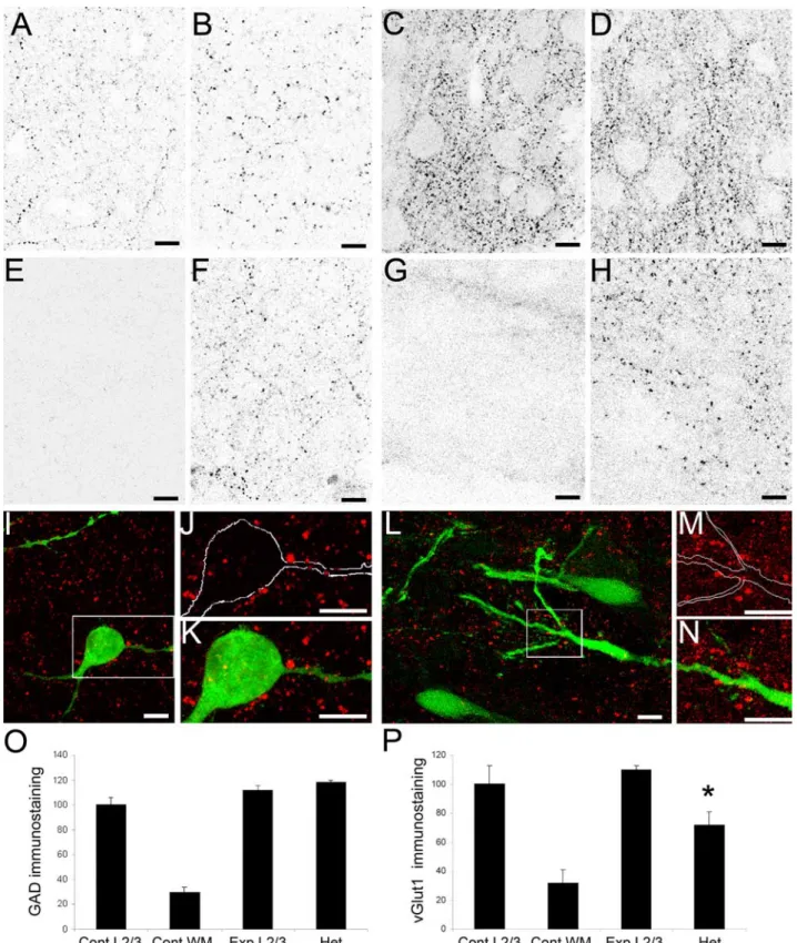 Figure 3. Distribution of GABAergic and glutamatergic terminals in DCX animals. A–N, Immunostaining with GAD65/67 (left panels) and vGlut1 (right panels) antibodies of cortical sections