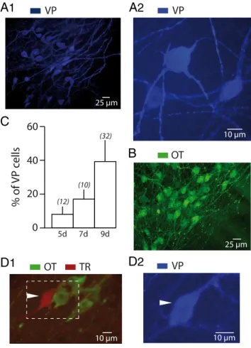 Figure 2. Basal electrical properties of VP neurons in organotypic slice cultures. A1, The top trace shows an intracellular recording from a VP neuron in a 10-week-old culture from a 9-d-old rat