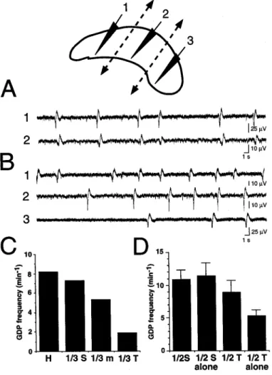 Figure 6. GDPs in medial septum originate in the hippocampus. Extra- Extra-cellular field potentials were recorded simultaneously from the medial septum (top scheme, S) and from the CA3 hippocampal region (top scheme, H1, H2) before (A) and after (B) cutti