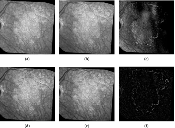 Figure 2. Example of Illumination correction. The three images on the top row represent the two original consecutive images (a) and (b), and their raw difference in absolute value (c); on the bottom row: the same images after illumination correction (d) an