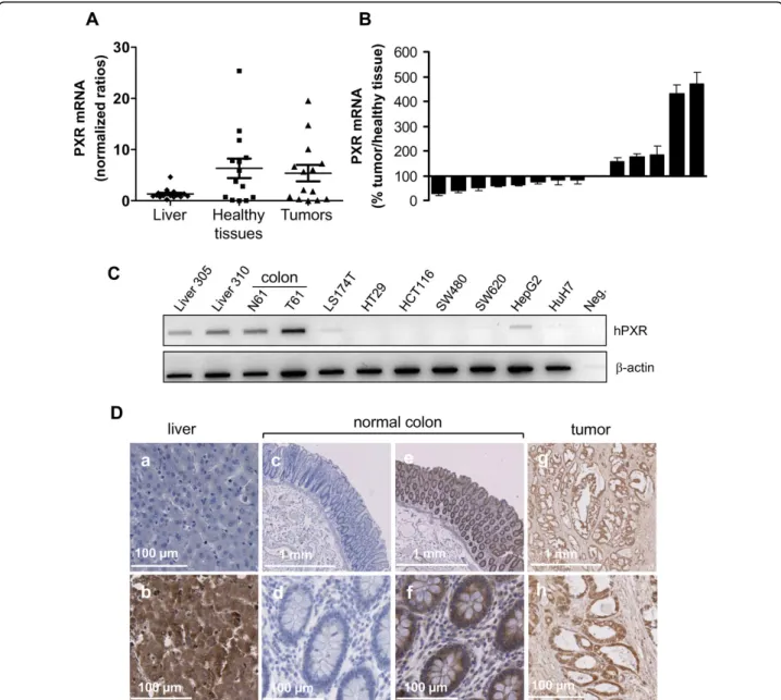 Figure 1 Evaluation of PXR expression in human colorectal tissues and cell lines. A, PXR mRNA expression measured by quantitative real- real-time PCR in human livers (n = 17) and colon samples (tumoral and healthy adjacent tissue, n = 14)