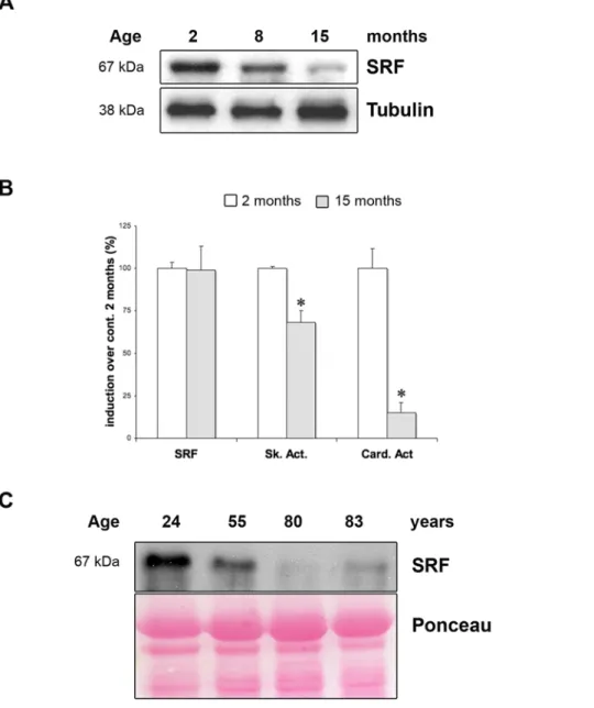 Figure 6. Age-dependant down-regulation of SRF expression in skeletal muscle of mice and human