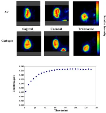 Figure 1 shows images from two of the pilot studies. Fig- Fig-ure 1 (top) shows sagittal, coronal, and transaxial slices