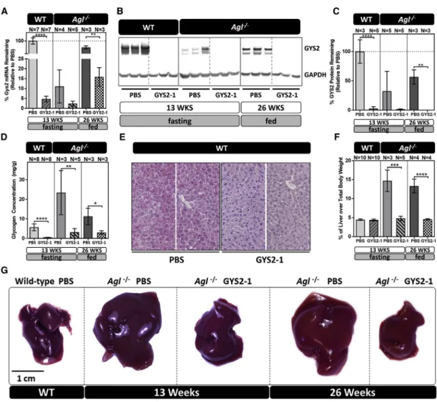 Figure 2. GYS2-1 Treatment Reduces Gys2 mRNA, GYS2 Protein Expression, Glycogen Synthesis, and Hepatomegaly in GSD III, Agl –/– Mice