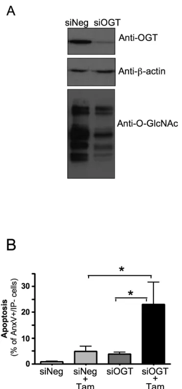 Figure  3.    Inhibition  of  OGT  expression  sensitizes  MCF-7  cells  to  tamoxifen-induced  apoptosis