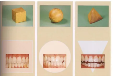 Figure I.2 : les 3 types de morphologies dentaires.(( 24).Fradeani.M)) 