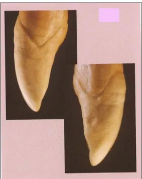 Figure I.31 : forme dentaire  basique(34) 