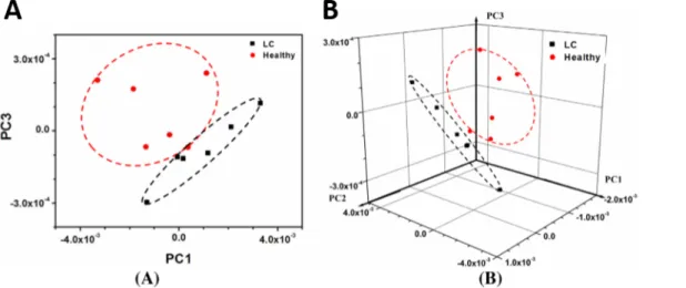 Figure 11. 2-D (a) and 3-D (b) PCA score plots for sensor responses to breath samples from  healthy  individuals  (red  circles)  and  lung  cancer  patients  (black  squares)