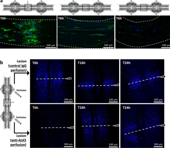 Figure 5.  Ex vivo ALK4/5-dependent microglia recruitment assays. (a) Confocal microscopy analysis of  Iba1 immunofluorescence using rabbit polyclonal anti-Iba1 antibodies 6 h after a lesion (left) or 6 h after no  lesion (middle and right)