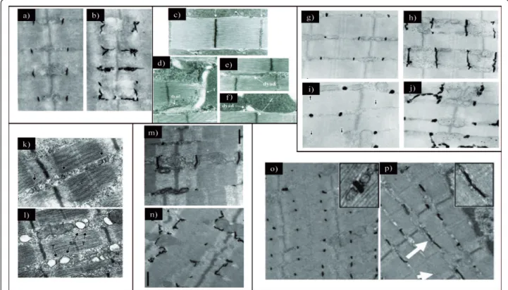 Figure 3 Proteins implicated in triad organization in skeletal muscle. (a) Electron microscopic image showing ferrocyanate-treated muscle from wild-type mouse