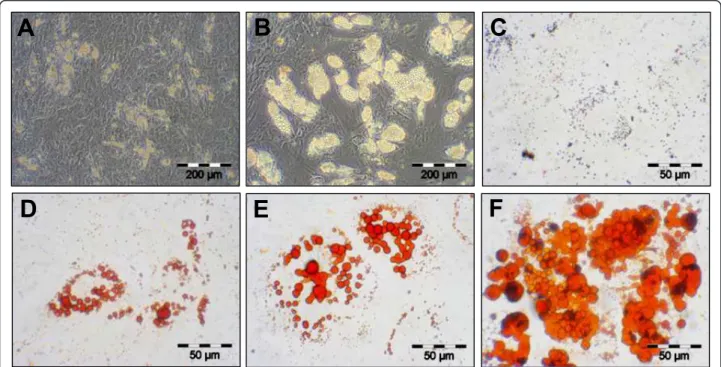 Figure 3 Adipogenic differentiation potential of human MSC (A-F). First the adipogenically induced human MSC lipid droplet formation became visible at day 5 (A)