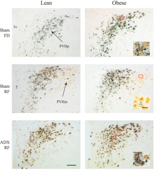 Fig. 9. Bright-field photomicrographs demonstrat- demonstrat-ing CRH mRNA expression (silver grains) and Fos immunoreactivity (brown staining) in the PVHp and PVHm in lean and obese sham-operated (top and middle) or ADX (bottom) Zucker rats