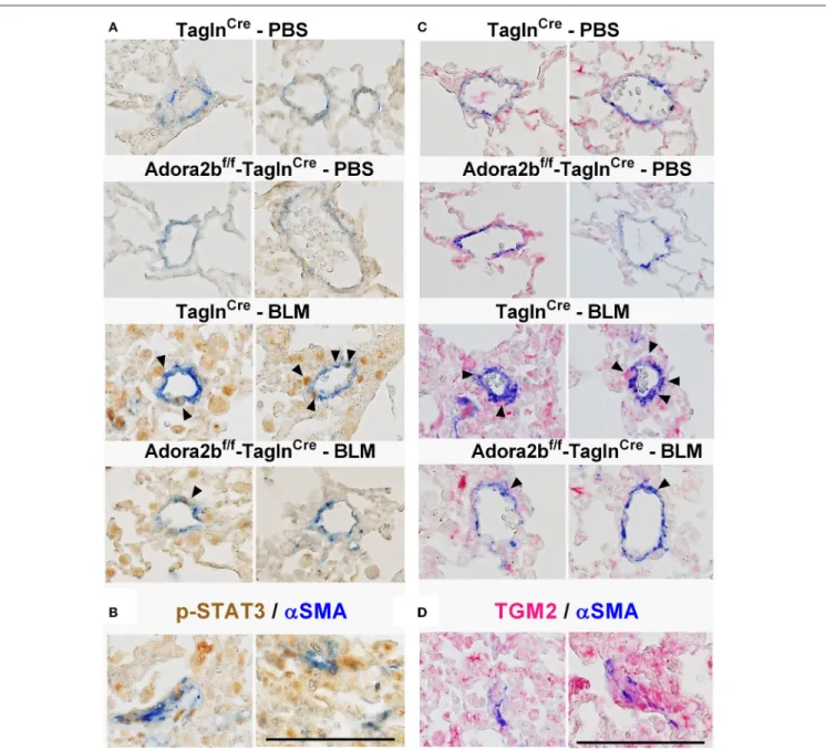 FIGURE 11 | Dual immunohistochemistry (IHC) from representative vessels from PBS or BLM exposed Tagln Cre and Adora2b f/f− Tagln Cre mice stained for (A) alpha smooth muscle actin (αSMA, blue) and nuclear P-STAT3 (brown signals); (B) represent fibrotic are