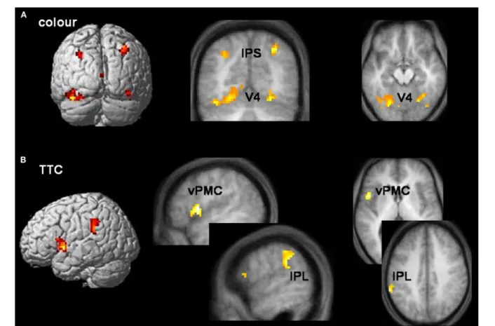 Figure 3 | Task-specifi c networks. (A) Colour tasks preferentially activated visual area V4 (x, y, z =  − 18,  − 75,  − 12; 36,  − 60,  − 21) and intraparietal sulcus (IPS)  (x, y, z =  − 30,  − 69, 39; 30,  − 66, 42) bilaterally during both allocentric a
