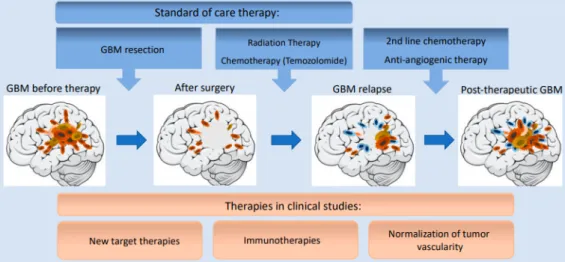Figure 2. Progression of GBM development during standard-of-care and second line therapies.