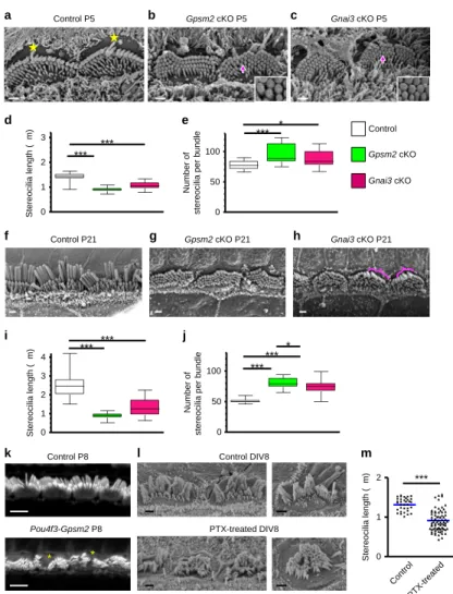 Figure 2 | Gpsm2 and Gnai3 mutations inhibit stereocilia elongation. (a–c) SEM of cochlear inner hair cells (IHC) from controls (a), Gpsm2 (b) or Gnai3 cKOs (c) in P5 mouse