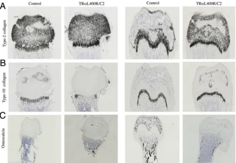 Figure 5. Expression of TR ␣ 1 L400R in chondrocytes alter both chondrocytes and osteoblasts populations in femurs (A) In situ hybridization of Col2a1, encoding type II collagen showing a specific expression restricted to the cartilage