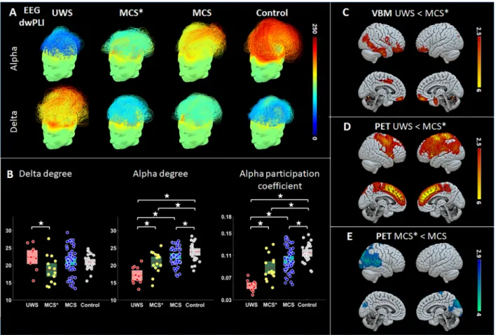 FIGURE 4: Neurophysiological and neuroimaging groups’ results. EEG results showed a higher functional connectivity in alpha band and lower connectivity in the delta band ranging from VS/UWS to MCS* to MCS and controls, with blue colors representing low con