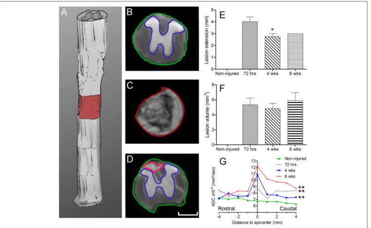 FIGURE 1 | Ex vivo diffusion 1 H-MRI assessments following SCI. 3D reconstruction of an injured spinal cord (A), the red area represents lesion extension
