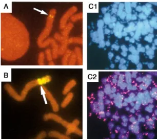 Figure 1. Gene amplification in mammalian cells can be intra- or extra-chromosomal. Fluorescent in  situ hybridization (FISH) with a probe specific to the AMPD2 gene was performed in cells either  unamplified (A) or exhibiting intra- (B) or extra-chromosom