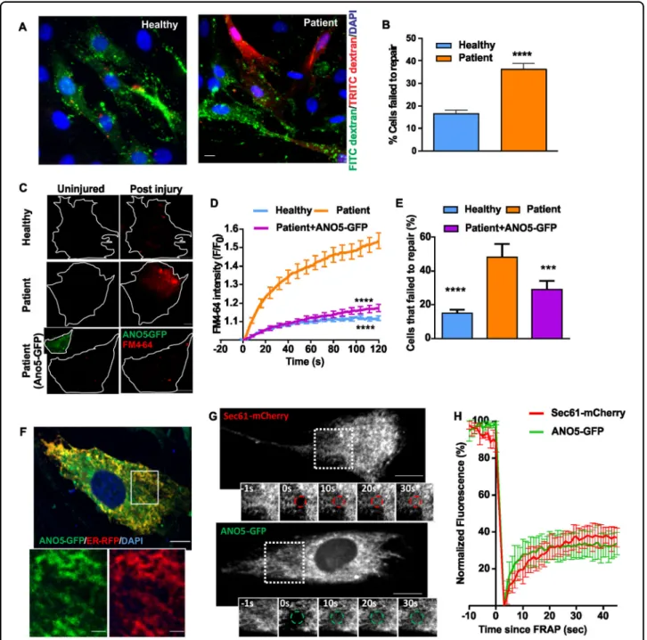 Fig. 2 ANO5 is an ER protein that is required for muscle PMR. a, b Glass bead injury assay for healthy and patient myoblasts