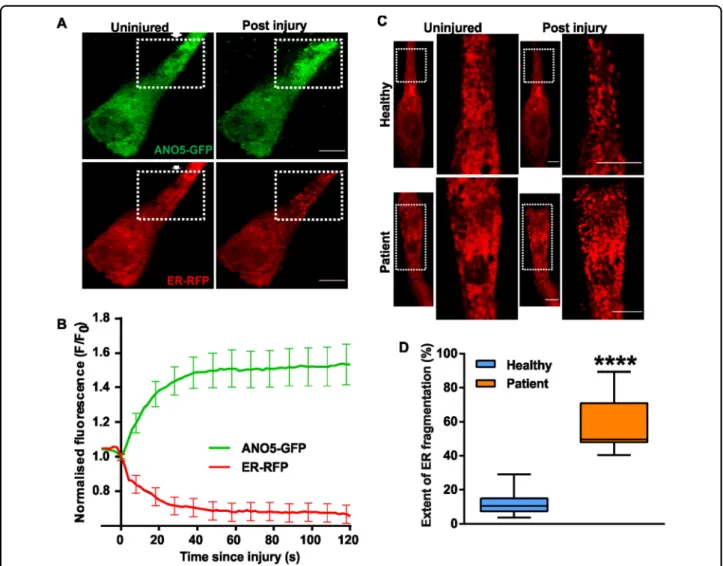 Fig. 3 Effect of injury on the ANO5 distribution and ER structure. a Images of healthy myoblasts expressing ANO5-GFP and RFP-KDEL are injured (at site marked by the arrow) by laser beam