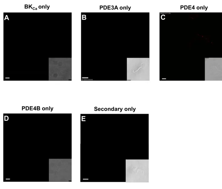 Figure S3. Negative control experiments of in situ PLA using the following primary antibodies: anti-BK Ca -subunit alone (A), anti-PDE3A alone (B), anti-PDE4 alone (C), an anti-PDE4B alone (D), or relevant pair of Duolink® oligonucleotide-associated second
