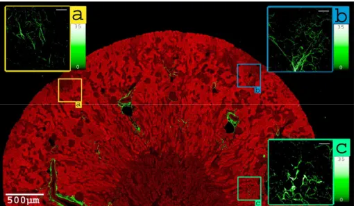 Fig. 5. (2.2 MB) Corrected 2PEF/SHG image mapping 2.3×4.6 mm² of an unlabeled fibrotic  murine kidney with 0.8×0.8 µ m² pixel size (2967×5865 pixels scanned at 100 kHz, with 20× 