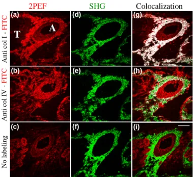 Fig. 1. Comparison of SHG imaging to immunolabeling of collagens type I and type IV in  serial frozen sections of murine renal tissue showing artery (A) and tubules (T)