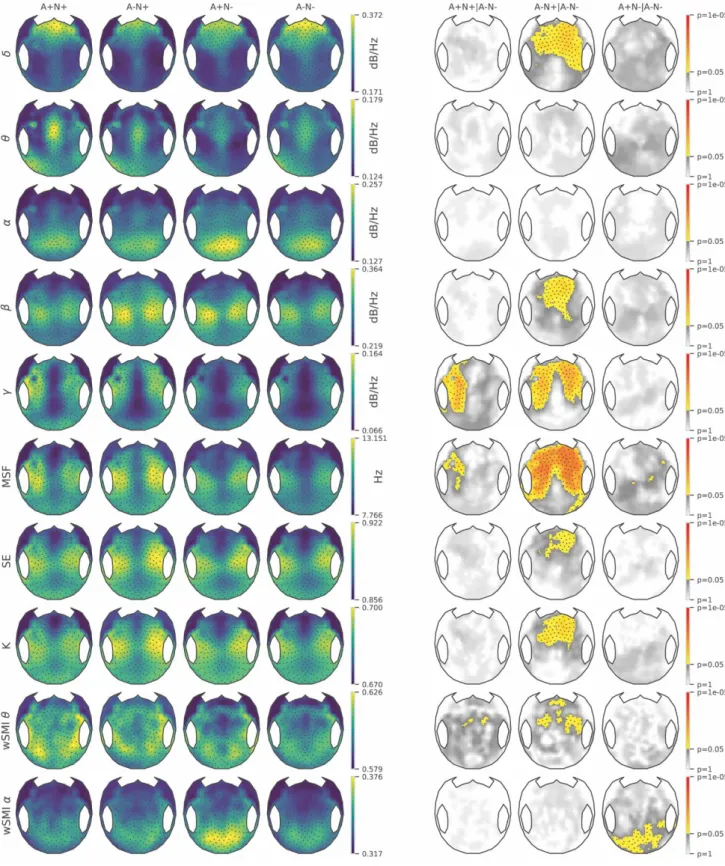 Figure 6: 224 electrodes topographical maps of EEG metrics. The topographical 2D projection (top =  front) of each measure [normalized power spectral density in delta (δ), theta (θ), alpha (α), beta (β), gamma  (γ), median spectral frequency (MSF), spectra