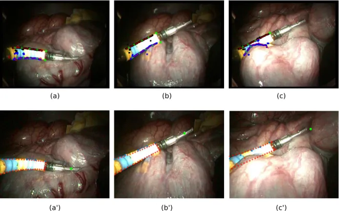 Fig. 8: In vivo results of the presented method with intestine in the background: (Top images)  the features extraction process and (bottom images) the virtual projection of the instrument from  the estimated pose (red crosses)