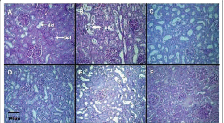 Figure 1 Renal histological evaluation by light microscopy (Periodic Acid-Schiff, ×400)