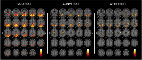 Figure 2.  Group activation maps (p  <  0.005; k  =  20; FDR corrected at cluster level p  <  0.05) during VOL,  CONV and WPHF protocols, compared to rest, performed at 10% of maximal voluntary contraction force