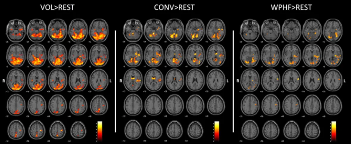 Figure 4.  Whole brain contrast maps (p < 0.005; k = 20; FDR corrected at cluster level p  < 0.05) between VOL  and the two NMES protocols